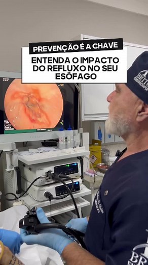 Refluxo constante pode ser um sinal de alerta! Exames preventivos ajudam a identificar condições como o Esôfago de Barrett, que pode evoluir para problemas graves. Cuide-se e não ignore os sinais! #dr.rubensbrito #SaúdeDigestiva #RefluxoGastroesofágico #EsôfagoDeBarrett #Endoscopia #CâncerDeEsôfago