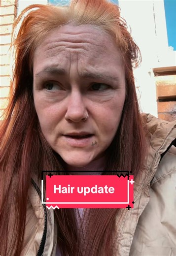 Hair update 🙃🤮🤣 .. #fyp #hair #scottish #fyp