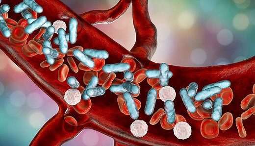 7 Warning Signs of Sepsis