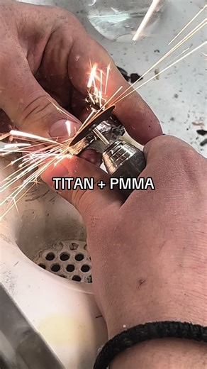 Titan PMMA: Perfecting Your Smile with Dental Labs