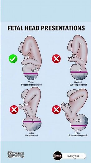 Normal & Abnormal Fetal Head Positions During Labour | Easy Anatomy Guide