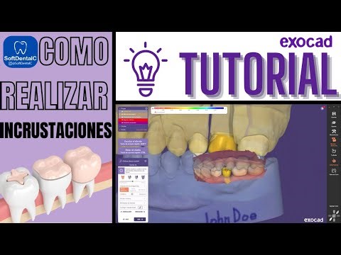 COMO REALIZAR INCRUSTACIONES EN #EXOCAD 🔥¡TUTORIAL SOFTDENTALC!