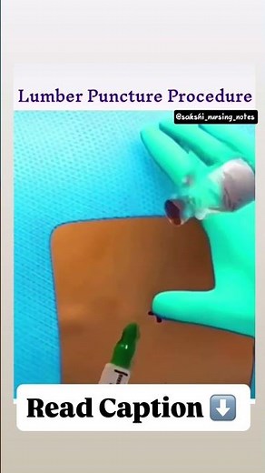 ✨ Lumbar Puncture Procedure Explained | Spinal Tap Medical Procedure 💉🧠