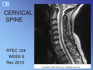 CERVICAL SPINE - SlideServe