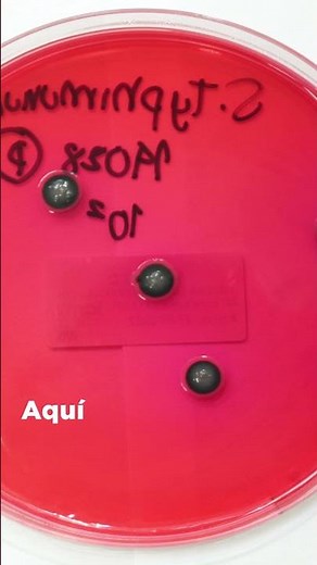 Medio de cultivo XLD: Salmonella Typhimurium