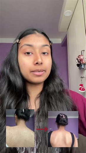 Back Acne Solutions: Fade Dark Spots & Clear Skin