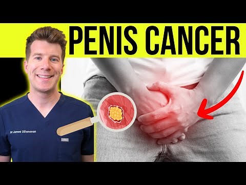 Doctor explains PENIS CANCER | Symptoms, causes and treatment