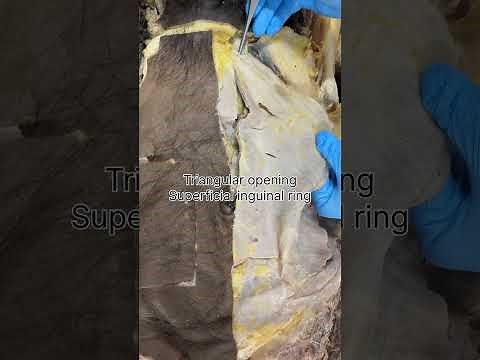 Muscles of Anterior abdominal wall- cadaveric dissection