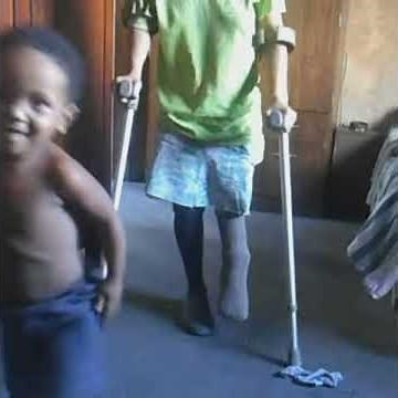 Shortleg crippled girl crutching in her house.