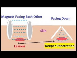 Morgellons Cure Step By Step Survival Guide! 832 343 5425