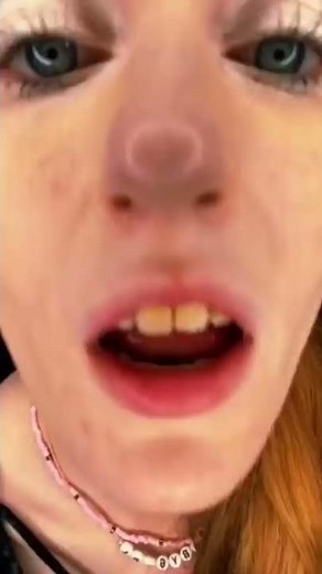 Yellowest Teeth In The World VS Orthodontist