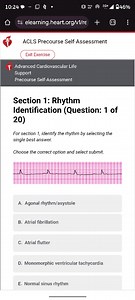 Section 1: Rhythm Identification (Question 1 of 20)For sectio... | Filo