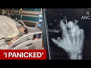 'I panicked': Firework blows up in young Arizona boy's hand