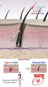 1.4M views · 2K reactions | this is how ICD 10 describes this problem...