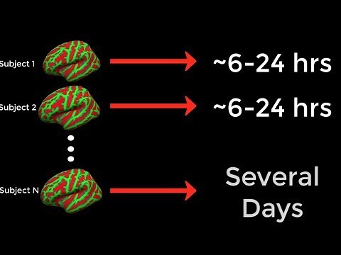 FreeSurfer #4: Running recon-all in Parallel