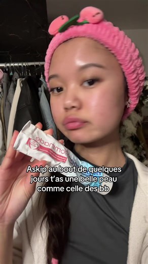 Jour 4// jsp sque vous en pensez vu de la cam ? J’ai juste des taches et les rougeurs jtrouve cv mieux