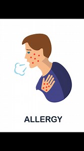 57K views · 555 reactions | Scabies Kya Hota Hai In Hindi Urdu? #scabies #scabiestreatment #scabiestreatmentinhindi #scabiestreatmenthindi #scabiessymptoms #scabiesinhindi #scabiesrash | DR. BILL | Facebook