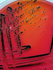 Salmonella on XLT-4 agar