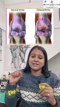 घुटने का दर्द #shortsfeed #physiotherapy #kneepain #arthritis #trendingshorts #fitness #foodie #tips
