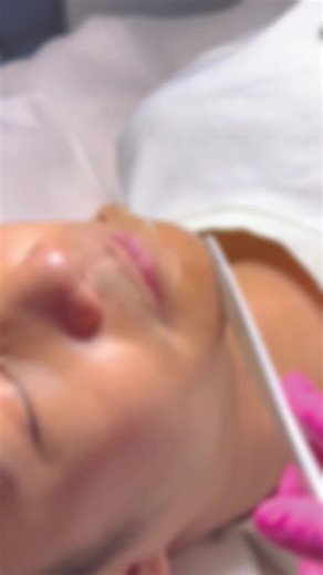 Tired of shaving? Go smooth for good. Beard Laser Hair Removal — Clean, Permanent, Hassle-Free #BeardFree #LaserHairRemoval #SmoothSkin #PermanentResults #NoMoreShaving ☎️Book Now: 0143931499