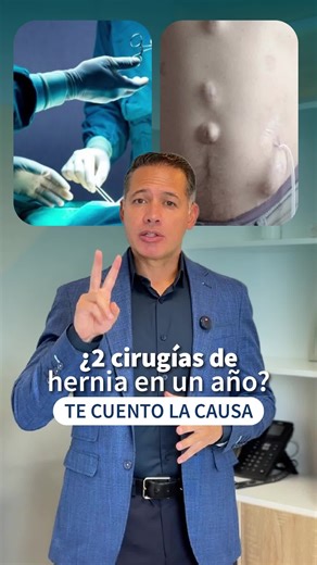 🩺 Hernia incisional: ¿Por qué reaparece? La hernia incisional aparece en el sitio de una cirugía abdominal previa y puede volver a formarse no solo por la técnica quirúrgica, sino también por factores del paciente. 🔎 Factores que aumentan el riesgo: 🚬 Fumar (afecta la cicatrización). ⚖️ Obesidad y exceso de peso (aumentan la presión abdominal). 🔁 Cirugías previas y debilidad del tejido. ❌ No seguir indicaciones médicas. ✅ Para reducir el riesgo: Dejar de fumar. Controlar el peso. Seguir el p