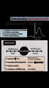 Hypercalcemia: ECG & Management #Cardiology #CriticalCare #Hypercalcemia #electrolyteimbalance #EmergencyMedicine #MedEd #ECG | Abdallah Othman