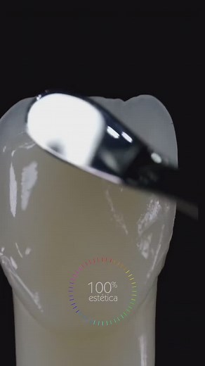 Upper Central Composite 💫 #dentist | Dental Art