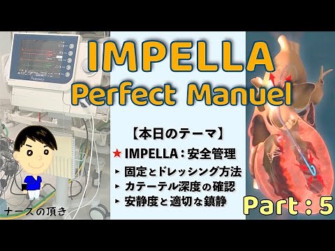 【インペラ患者を守るための管理とは？】IMPELLA Part：5《固定のポイントを理解しよう！》