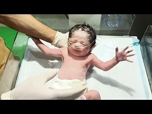 🩺 Initial Assessment of Newborn Baby | Checking Reflexes & Chest Auscultation in NICU