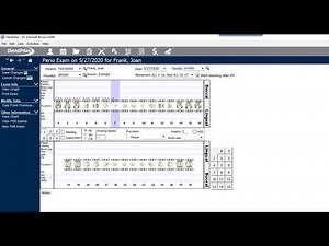 Negative Perio Probing Options