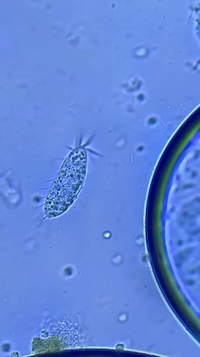 Explorando el Mundo de las Bacterias bajo el Microscopio