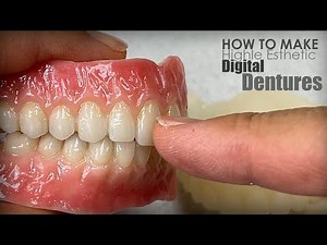 How to Make Highly-Esthetic Digital Dentures
