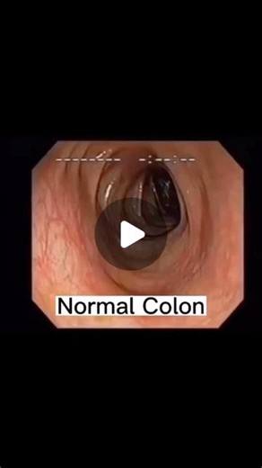 Higher To Health on Instagram: "What you put in is what you get out. The food we eat doesn’t just get digested and pooped out. Whatever can’t get digested gets stored for later and literally keeps getting processed over and over. Many of us consume toxic foods that cause mental cloudiness that affects our moods and decisions we make. This is an ongoing cycle that we must battle in order to overcome in order to gain balanced health. If someone wants to do something about his/her health, I can hig