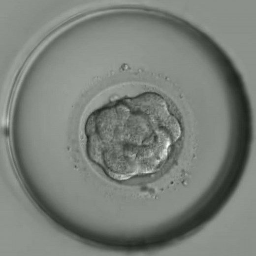 最新タイムラプス観察：受精から胚盤胞までの成長