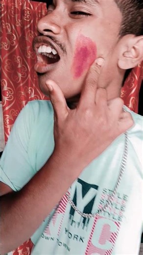 Boy’s Cheeks Turned RED 😳 Painful Reaction 😂