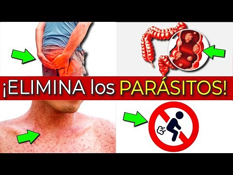 REVEALED! PARASITES in the INTESTINE ALARM SYMPTOMS | GET RID of PARASITES QUICKLY