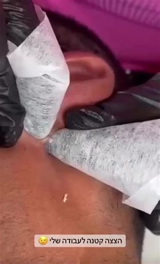 Gal Israeli Beauty Clinic ב-TikTok