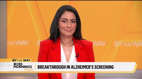 FDA approves first blood test to help screen for Alzheimer's disease