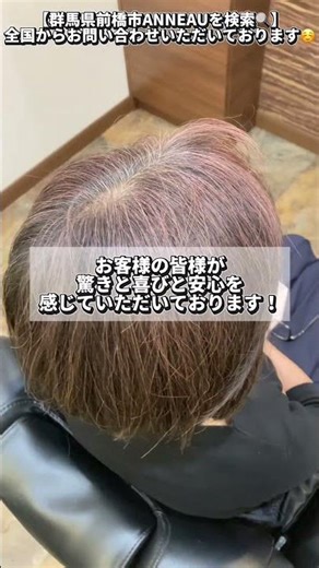 自分の頭皮の真実を知る！マイクロスコープで見える毛穴と健康状態#shorts