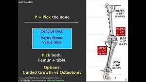 Assessment of Limb Alignment in the Frontal Plane Using the MAP Test