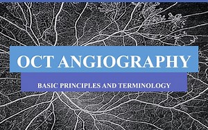 OCTA Part 1 principles and basic terminology - OCTA P1：原理与基础