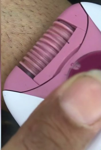 Hair removal whit epilator