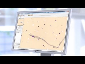 Introducing: Cellavision® Body Fluid Application