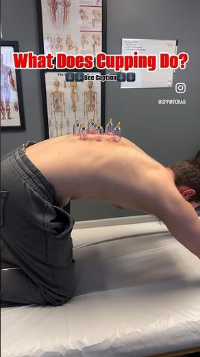 Cupping Therapy - What Does It Do, How Does It Work, and Is It Right for You?