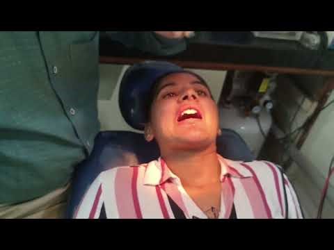 Painless removal of fractured premolar tooth