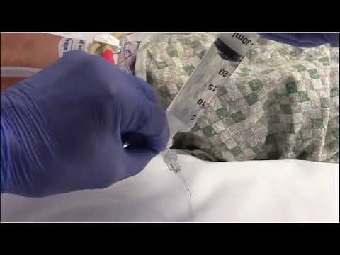 Intraabdominal Pressure Monitor