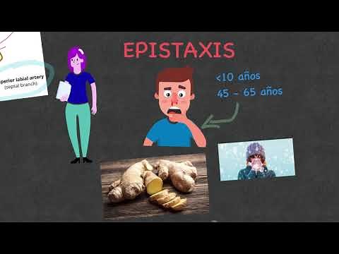 Epistaxis - Sangrado nasal: Etiología, diagnóstico y tratamiento.
