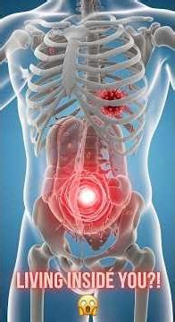 Maggots Inside Your Body? This Is What Happens 😨⚠️#skeleton