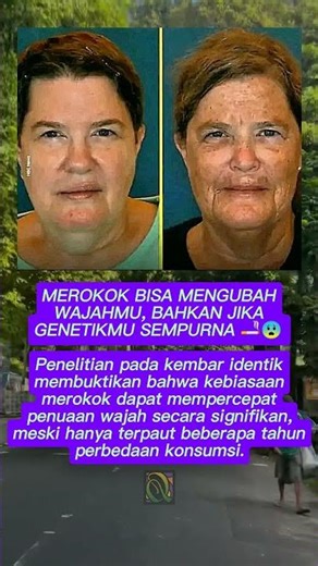 Studi Kembar Identik Ungkap Dampak Merokok pada Penuaan Wajah