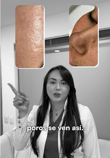 Activos efectivos para poros dilatados y puntos negros